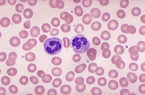 Image result for normal blood smear