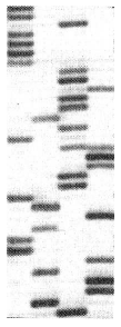 A patient wants to know if he is heterozygous for