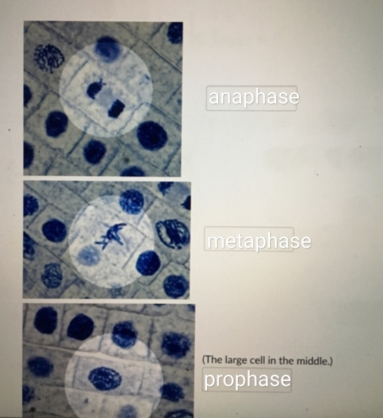 anaphase metaphase (The large cell in the middle.) prophase