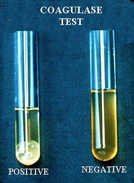 COAGULASE TEST NEGATIVE POSITIVE