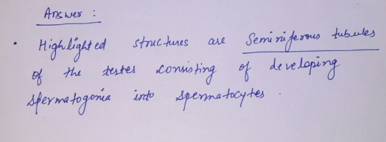 Answer : Highlighted structures are Seminiferous tubules of the testes consisting of developing spermatogonia into spermatocy