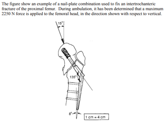 The figure show an example of a nail-plate combination used to fix an intertrochanteric 2250 N force is applied to the femoral head, in the direction shown with respect to vertical. 15° 135 1 cm 4 cm