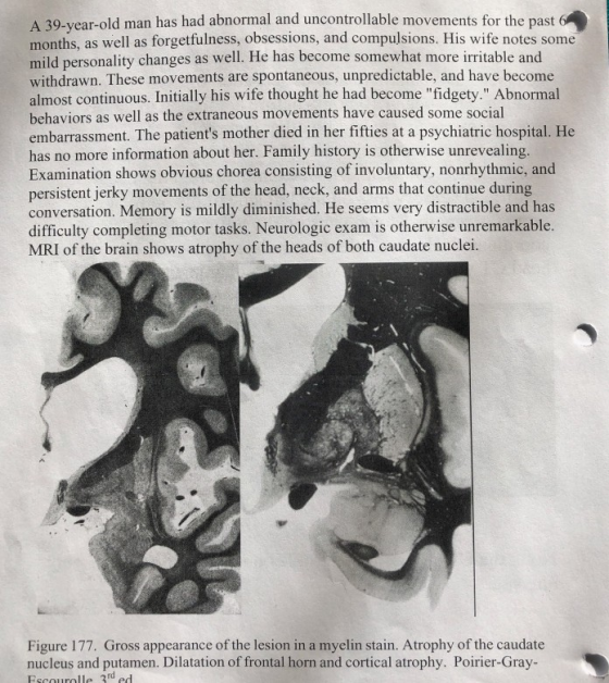 A 39-vear-old man has had abnormal and uncontrollable movements for the past 6 months, as well as forgetfulness, obsessions,