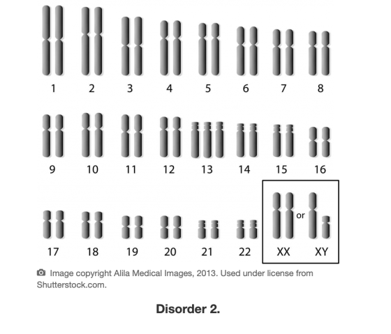 1 1 2 3 4 5 6 7 8 ilii 11 = 9 10 11 12 13 14 15 16 11 itis 17 18 19 20 21 22 XX XY 0 Image copyright Alila Medical Images, 20
