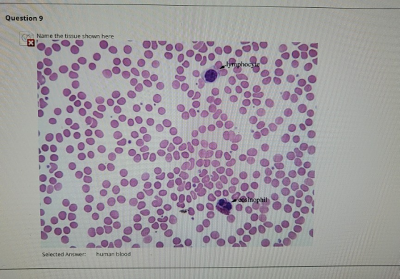 Question 9 Name the tissue shown here lymphocyte eosinophil Selected Answer: human blood