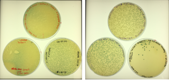 Section 1 apps X-35739 5.03.2020 Group 4 Sto. -a. ZOIS 2. spicillin + LB broth polypeptide plasma ee, Strut E.coli DHS Jerse
