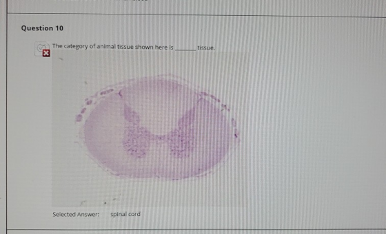 Question 10 The category of animal tissue shown here is tissue. Selected Answer: spinal cord