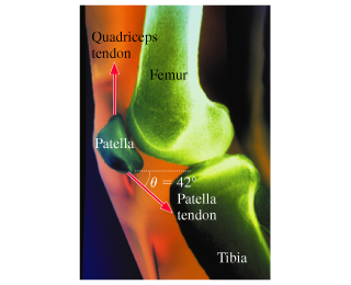 When you bend your knee, the quadriceps muscle is