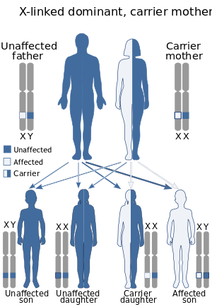 X-linked dominant, carrier mother Unaffected father Carrier mother I XX XY Unaffected Affected Carrier XY XX XX XY Un affecte