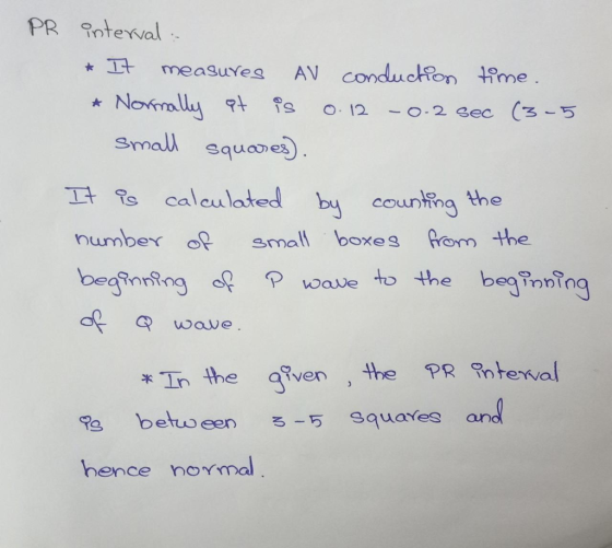 PR tewal AV conducton me MeasuYes Nomally a Small squae (3-5 O 12 -O-2 ec It calaulated by counting the number of fom the sma