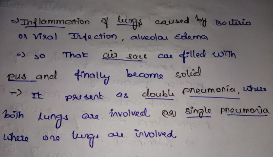 Inflammertion 4 lungs caused by Baituria of viral Infection, alvedau Edema - so that air sacs are filled with pus and finally