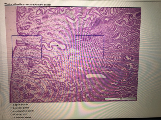 What are the dilate structures with the boxes? AVE 02 DO G C a spiral arteries b. cervicle glands c. endometrial glands d. sp