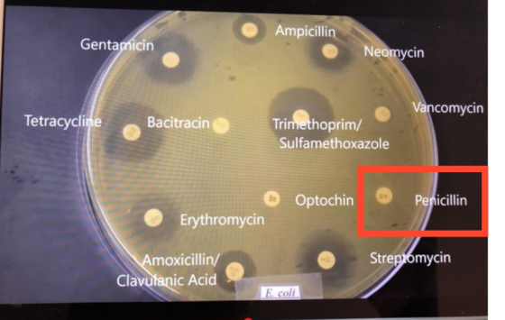Ampicillin Gentamicin Neomycin Vancomycin Tetracycline Bacitracin Trimethoprim/ Sulfamethoxazole © Erythromycin Optochin Peni