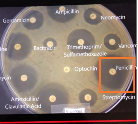 Ampicillin Neomycin Gentamicino Bacitracin ine Vancom Trimethoprim/ Sulfamethoxazole © Optochin Penicilli mycin Streptomycin