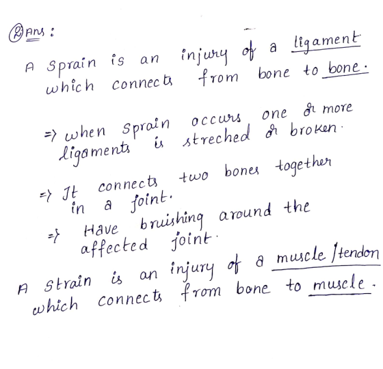 ©ans A Sprain is an which connects injury from of a ligament bone to bone · => when sprain occurs one or more ligaments is s