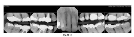 Fig. 12-14