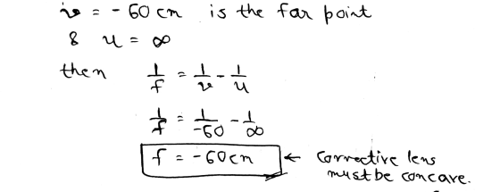 far point is =-60cm is the 8 u = so then $ to ý $ to do If=-60cm Corrective lens - must be concare.