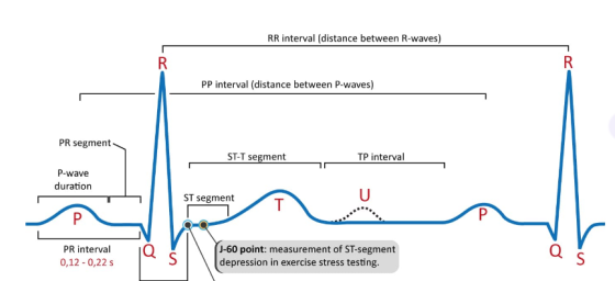 RR interval (distance between R-waves) PP interval (distance between P-waves) PR segment TP interval P-wave duration ST segment PR interval 0,12 0,22 s J-60 point: measurement of ST-segment depression in exercise stress testing