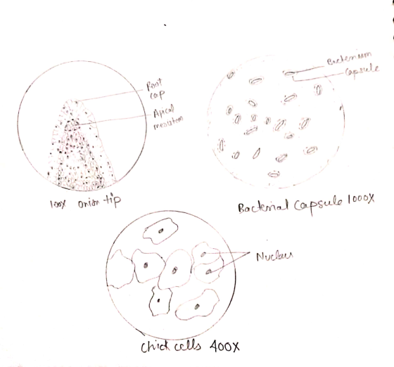 - Cochenum Rost -Apical menutom looy onion tip Bacterial capsule 1000x o Nucleus chick cells 400x