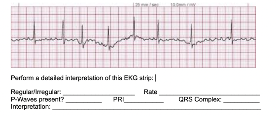 10 mm/my mamman ممممممممم Perform a detailed interpretation of this EKG strip: | Rate Regular/Irregular: P-Waves present? Int
