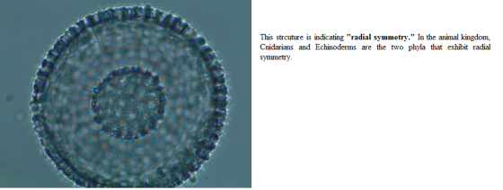 This strcuture is indicating radial symmetry. In the animal kingdom, Cnidarians and Echinoderms are the two phyla that exhi