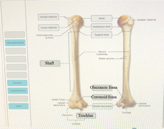 rebro Greater tuberde --- bede Anatomicated tertuberculo Sched tuberosity Shaft Olecranon fossa Coronoid fossa Trochlea Code