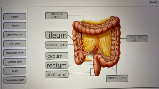 Reset Cecum transverse colon Rectum Ascending colon fileum descending colon Anal canal ascending colon Transverse colon cecum