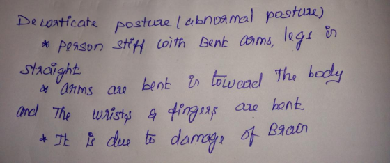 Decorticate posture l abnormal posture) * person stiff with Benk arms, legs is Staaight & arms are bent is tow and the body a