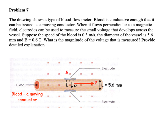 Problem 7 The drawing shows a type of blood flow meter. Blood is conductive enough that it can be treated as a moving conduct