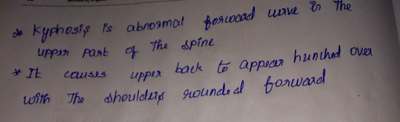 do kyphosis is abnormal forward wave is the - upper part of the spine It causes upper back to appear hunched over with the sh