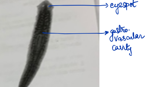> eyespot gastro Ivascular Carity