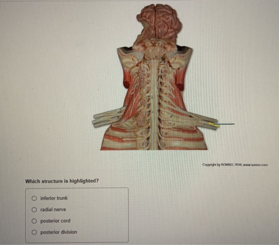 Copyright by SOMSO, 2010, www.SENTES COM Which structure is highlighted? O inferior trunk O radial nerve O posterior cord O p