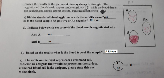 Sketch the results in the picture of the tray shown to the right. The agglutinated blood should appear sandy or gritty (@ l,