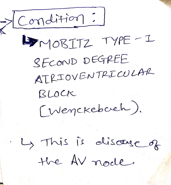 Condition : MOBITZ TYPE 3EcOND DEGREE ATRTOVENTRICULAL BLOCK