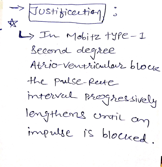 eeond degree tthe Prulse-Peste impulse fs blociked