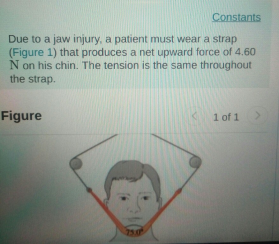 Constants Due to a jaw injury, a patient must wear a strap (Figure 1) that produces a net upward force of 4.60 N on his chin. The tension is the same throughout the strap Figure 1 of 1>