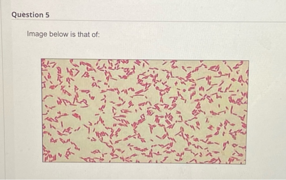 Question 5 Image below is that of: 790 is