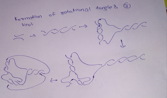 knot