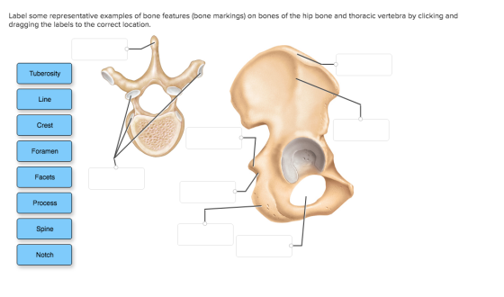 Label some representative examples of bone features (bone markings) on bones of the hip bone and thoracic vertebra by clickin