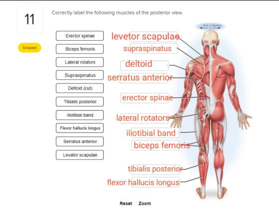 Correctly label the following muscles of the posterior view. Skipped Erector spinae) levetor scapulae Biceps femoris supraspi