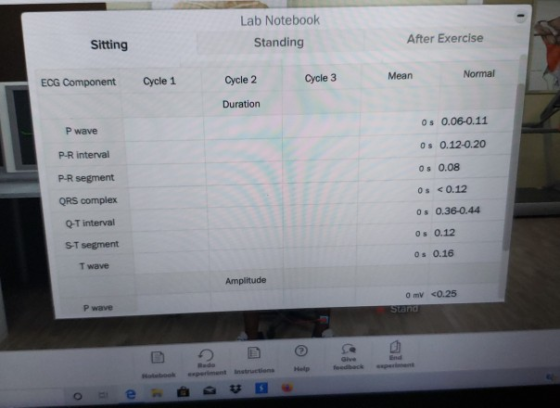 Lab Notebook Standing Sitting After Exercise Cycle 2 ECG Component Cycle 1 Cycle 3 Mean Normal Duration Os 0.06-0.11 P wave P
