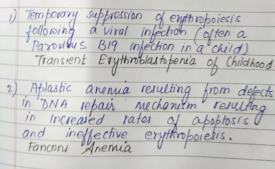 1 Tem povary suppression of erythropoiesis following a viral infection (often a Paroviaus B19 infection in a child) Transient