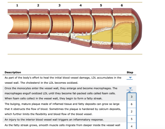 Description As part of the bodys effort to heal the initial blood vessel damage, LDL accumulates in the vessel wall. The cho