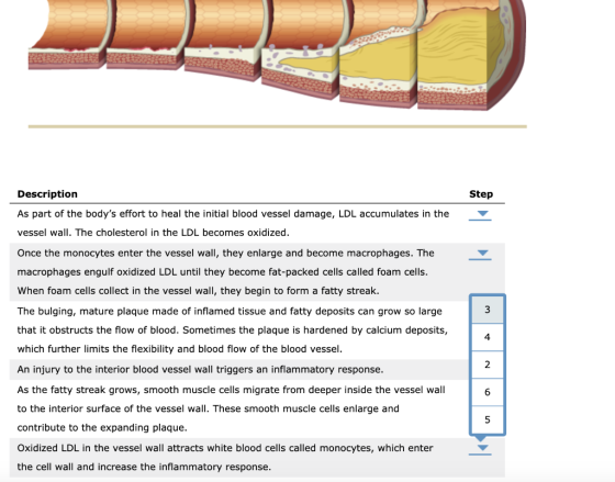 Description Step As part of the bodys effort to heal the initial blood vessel damage, LDL accumulates in the vessel wall. Th