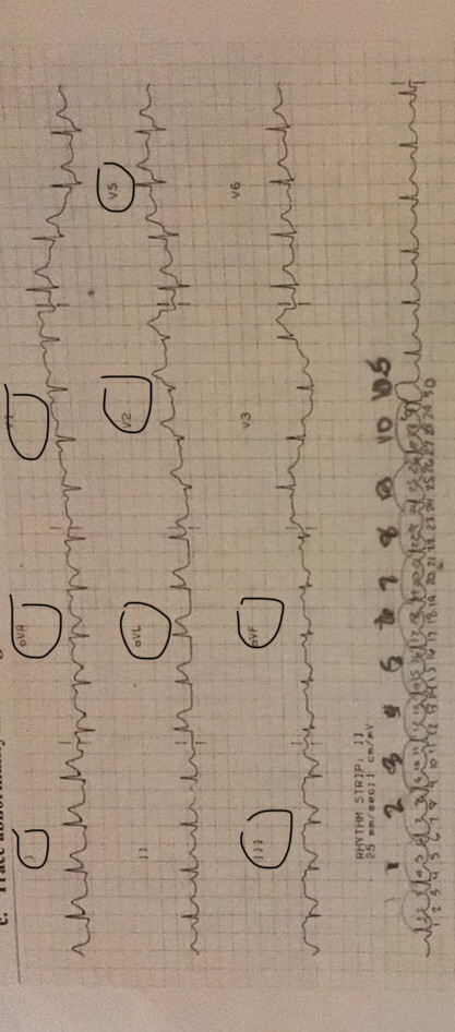 ☺ wenningun gen Orpha VL 0 0 0 merreinunuamordrer euerungen 29 walis 6 tea of 10 h 10 os ullitat