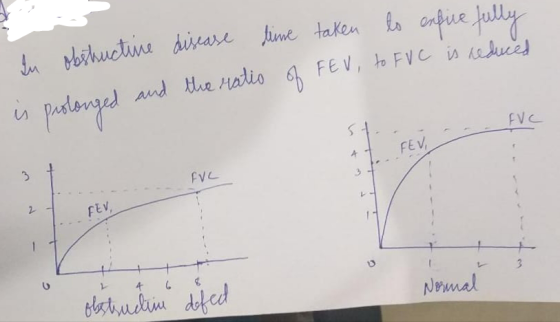 time taken lo exfice fully In obstructive disease is prolonged and the ratio of FEV, to FVC is reduced EVC FEV 3 FUL 2 FEV, 3