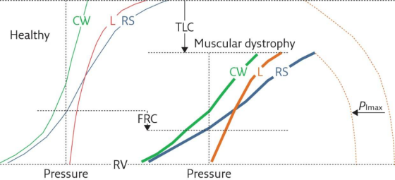 CW L RS TLC Healthy Muscular dystrophy CW LRS :Pimax . FRC RV Pressure Pressure