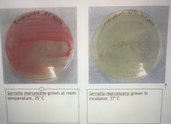 01356 curs 3 3/4/2016 smarcesins S.marisan Serratia marcescens grown at room temperature, 25°C Serratia marcescens grown in i