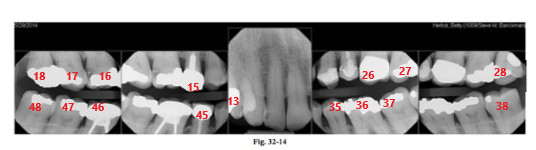 18 27 17 16 26 28 15 13 48 47 46 35 36 37 38 45 Fig. 12-14