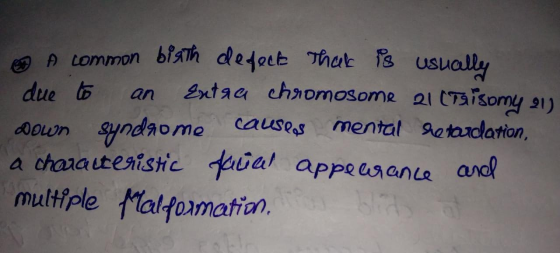 A common biath defect that is usually due to an Entga chromosome 21 Taisomy 213 Down syndrome causlas mental retardation, a c